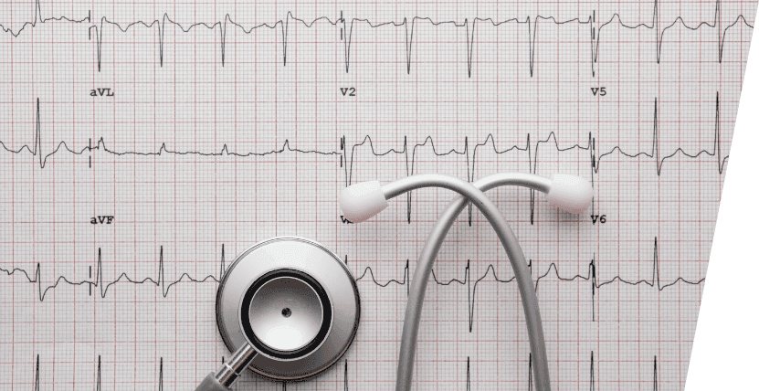 Understanding ECG and the Benefits of Getting an ECG at Home