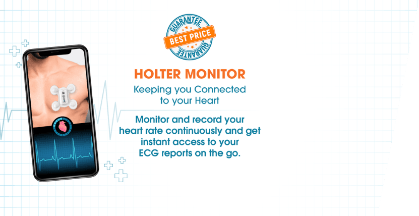 Holter Monitor